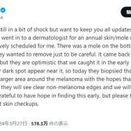 X（旧Twitter）より引用