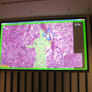 「Opect（オペクト）」を使用している時の画像。患者の体内の画像が表示されます