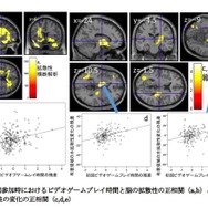 初回参加時におけるビデオゲームプレイ時間と脳の拡散性の正相関（a,b）と数年後の脳の拡散性の変化の正相関（c,d,e）